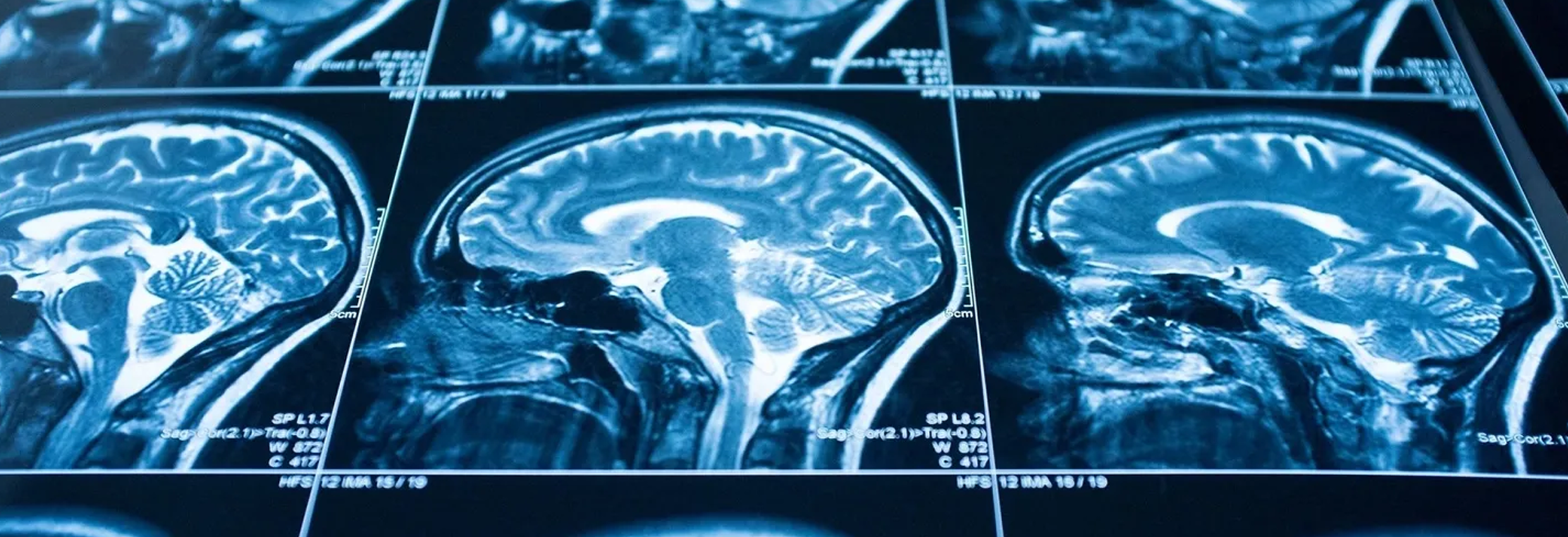 image MRI brain scans in blue-toned images.